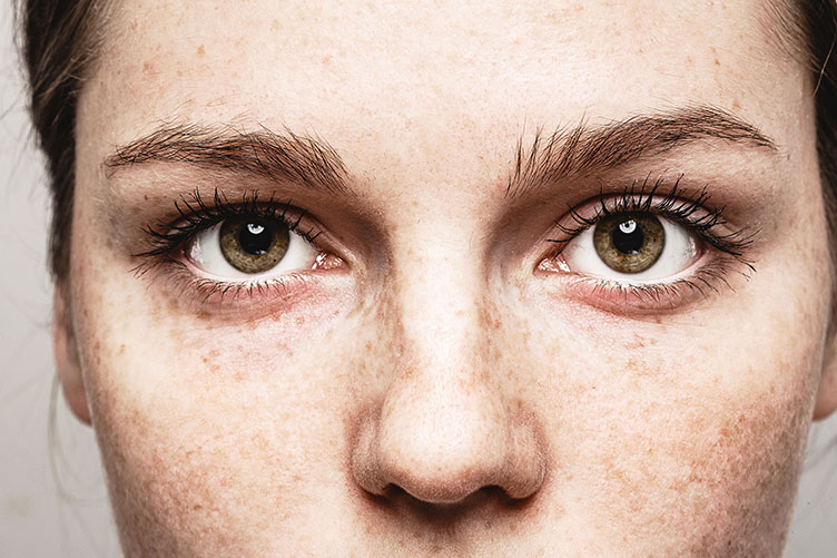 8 Tipps gegen trockene Augen